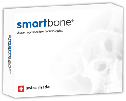Pack-smartbone ibi smartbone® packaging